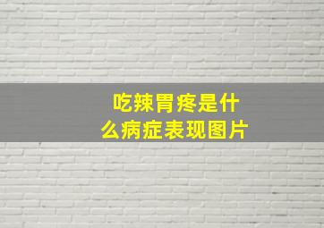 吃辣胃疼是什么病症表现图片