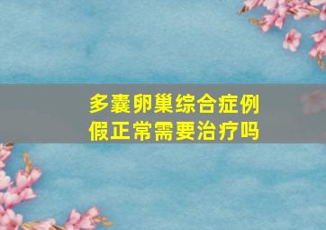 多囊卵巢综合症例假正常需要治疗吗