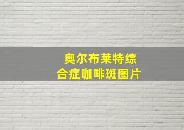 奥尔布莱特综合症咖啡斑图片