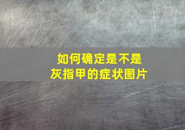 如何确定是不是灰指甲的症状图片