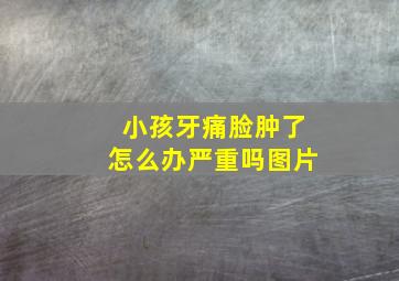 小孩牙痛脸肿了怎么办严重吗图片