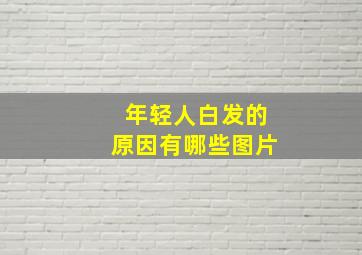 年轻人白发的原因有哪些图片