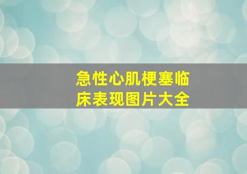 急性心肌梗塞临床表现图片大全