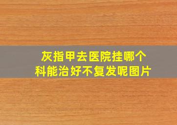 灰指甲去医院挂哪个科能治好不复发呢图片