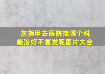 灰指甲去医院挂哪个科能治好不复发呢图片大全