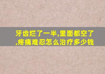 牙齿烂了一半,里面都空了,疼痛难忍怎么治疗多少钱