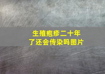 生殖疱疹二十年了还会传染吗图片