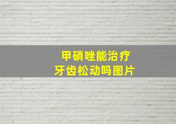 甲硝唑能治疗牙齿松动吗图片