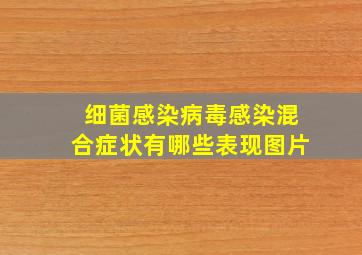 细菌感染病毒感染混合症状有哪些表现图片