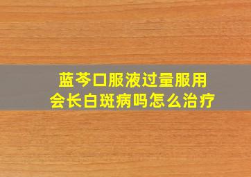 蓝芩口服液过量服用会长白斑病吗怎么治疗